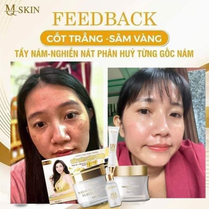 Hình ảnh review Combo Sâm Vàng Mq Skin từ khách hàng sau khi sử dụng