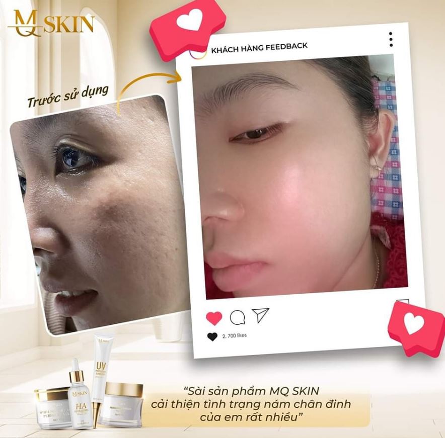 Hình ảnh review từ khách hàng sau khi sử dụng