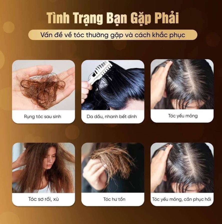 Dầu Gội Tỏi Đen Black Garlic Shampoo