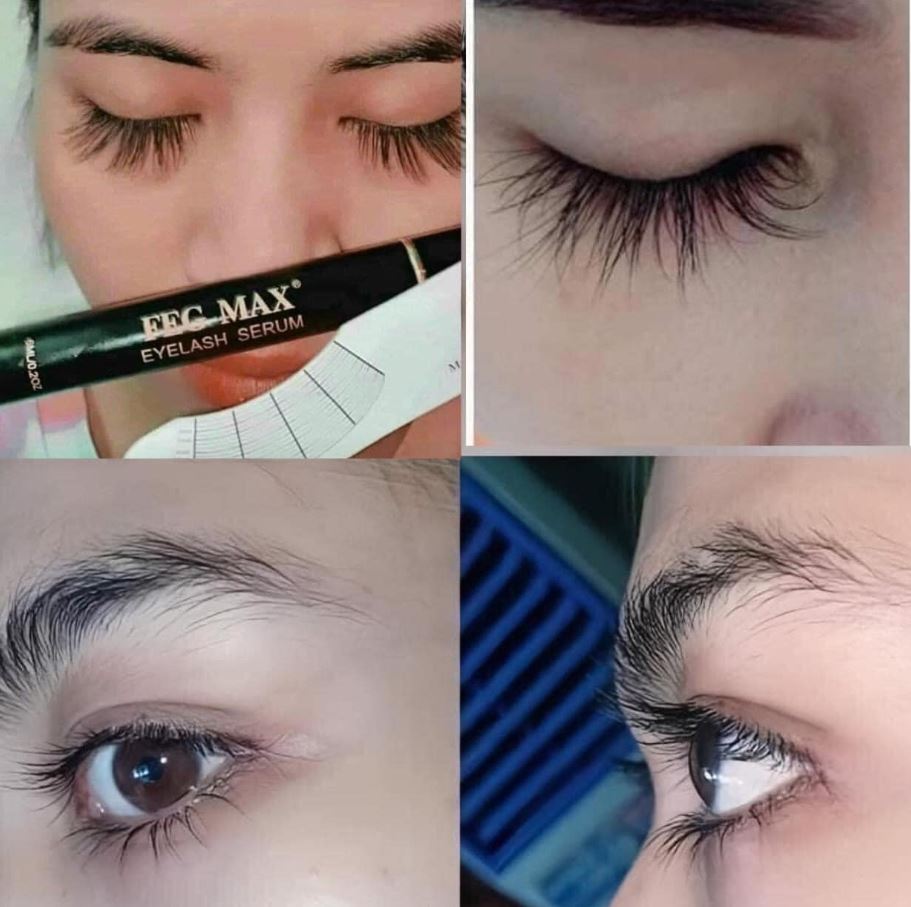 FEG MAX - Lựa chọn tối ưu cho vẻ đẹp tự nhiên của đôi mắt bạn