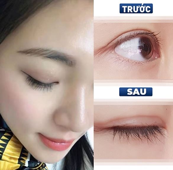 Dưỡng mi FEG PLUS thích hợp cho mọi đối tượng