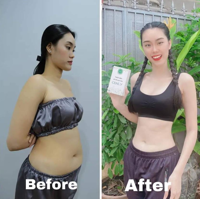 Cenly, viên uống giảm cân tự nhiên