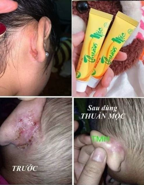 Sản phẩm hỗ trợ điều trị nhiều tình trạng da khác nhau