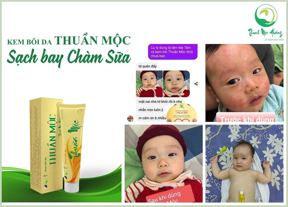 Sản phẩm bôi da hiệu quả và an toàn cho bé