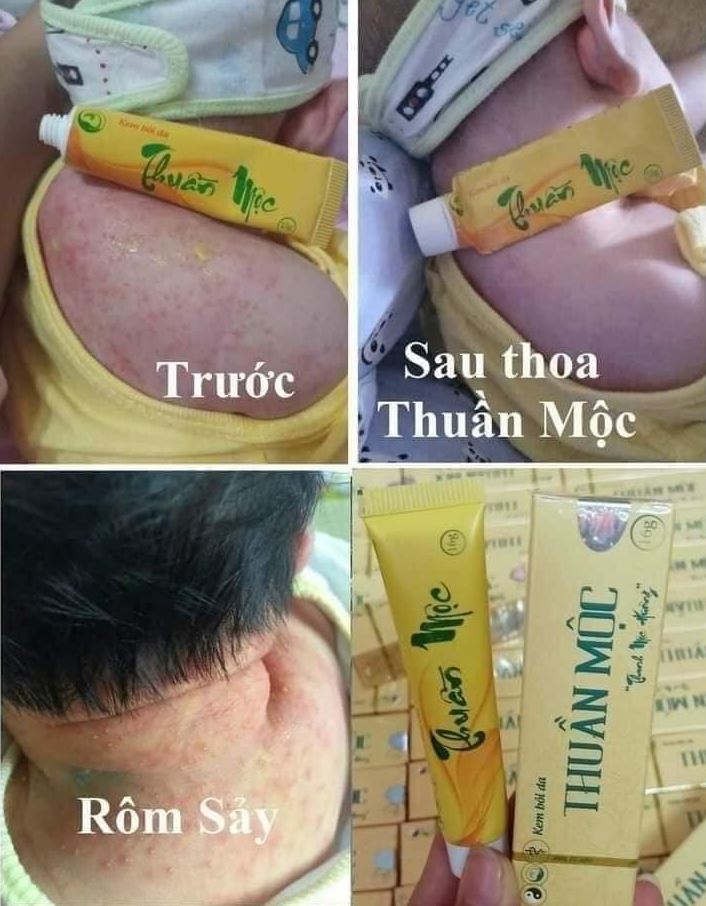 Review kem bôi da Thuần Mộc từ khách hàng
