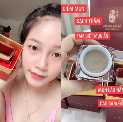 Sản phẩm này có khả năng điều trị các loại mụn phổ biến