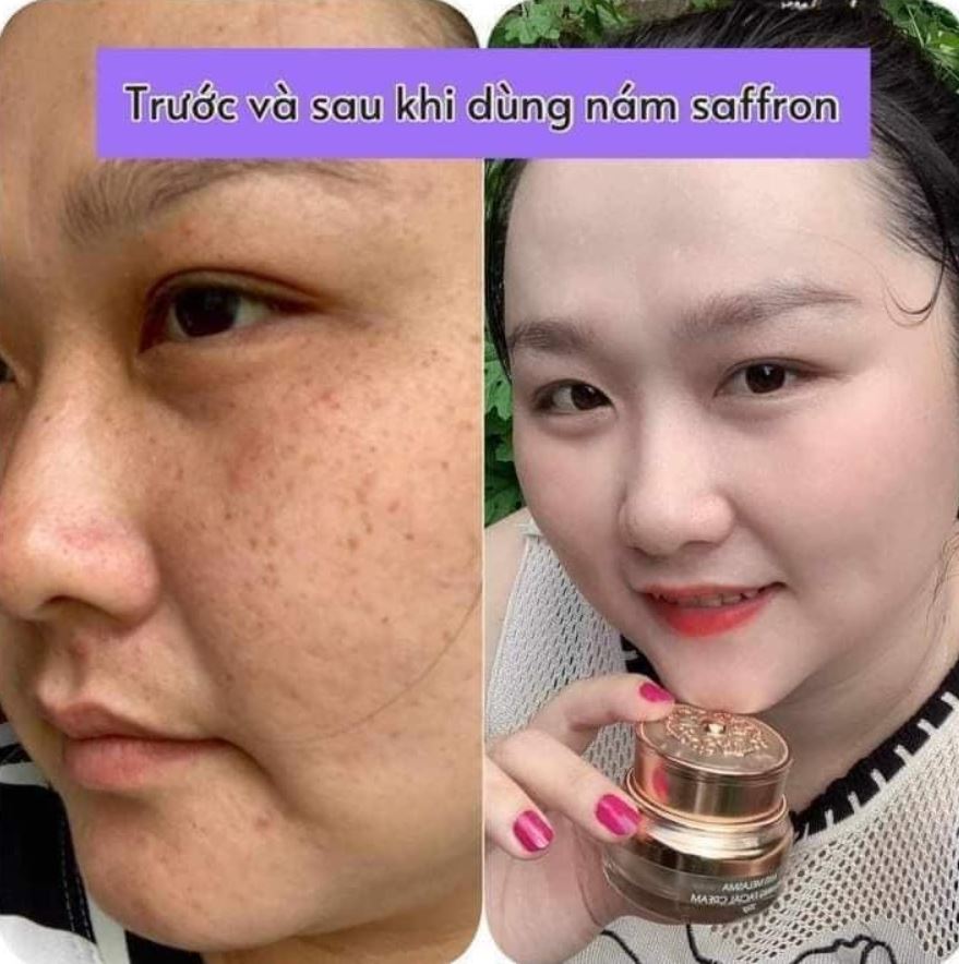 Hình ảnh review từ khách hàng sau một thời gian sử dụng