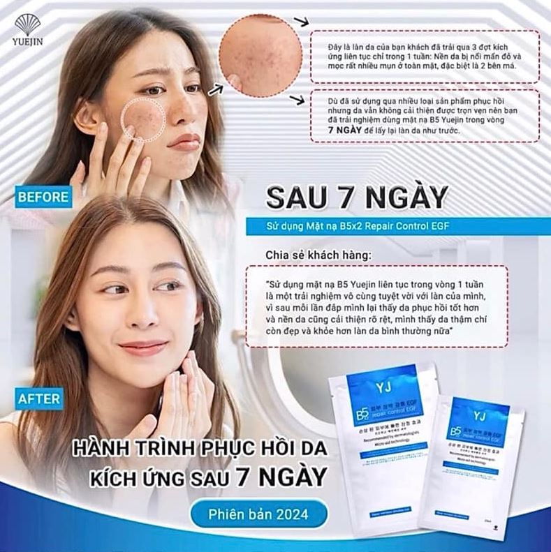 Bổ sung vitamin giúp chống lại quá trình lão hóa, tái tạo làn da từ bên trong