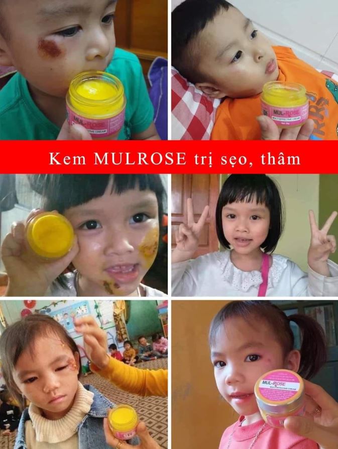 Một vài hình ảnh review từ người dùng