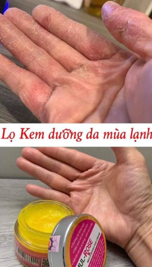 Review kem nghệ MulRose từ khách hàng