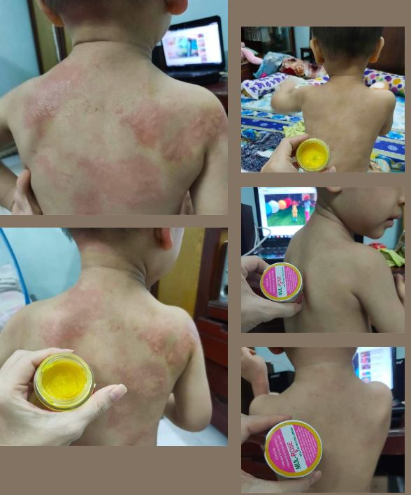 Hướng dẫn sử dụng sản phẩm Mul-Rose