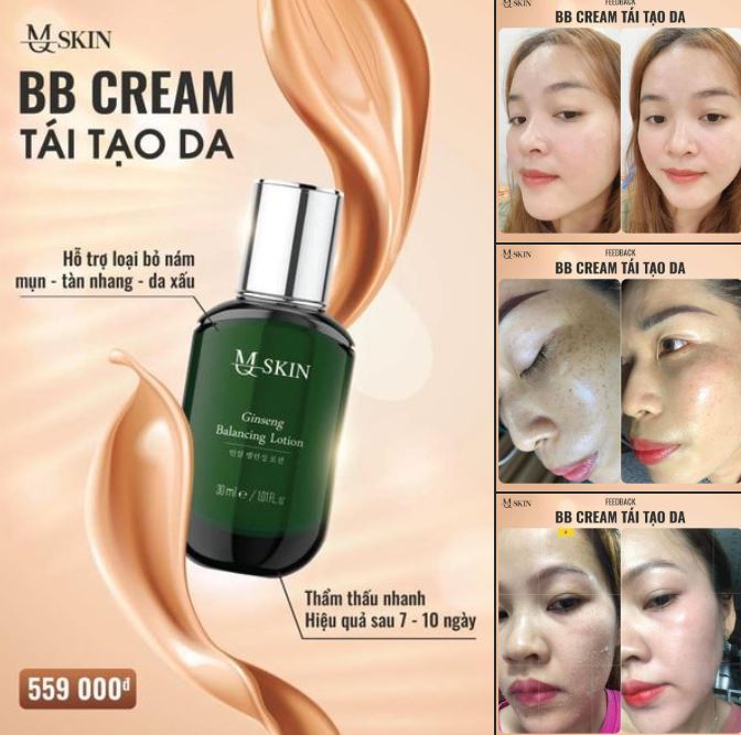 Thay da BB Cream MQSkin
