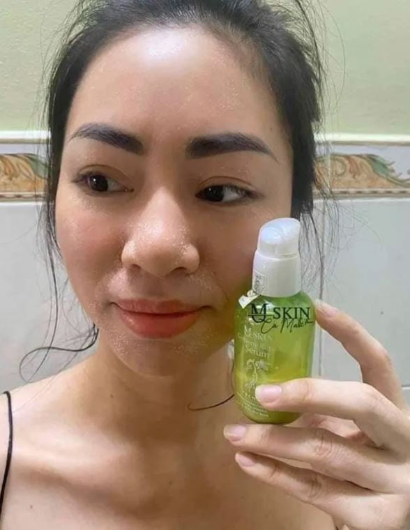 Review tái tạo da nhân sâm Mq Skin từ khách hàng