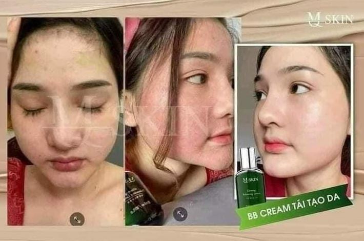 Kem Tái Tạo Da BB Cream MQSkin phù hợp với mọi loaij da