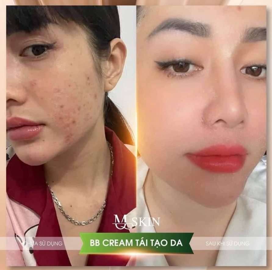 Tái Tạo Da BB Cream MQSkin review từ khách hàng