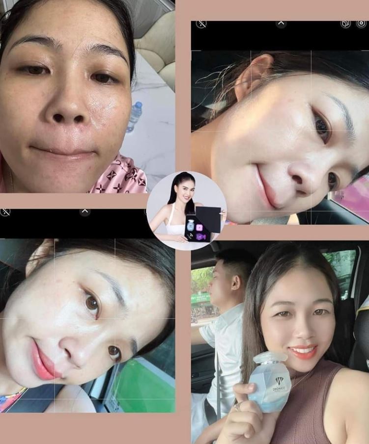 Review Viên Uống trắng da Ngọc Trinh Diamond White Day