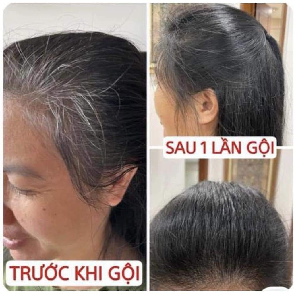 Dầu gội phủ bạc Sin Hair được thiết kế để phù hợp với đa dạng loại da đầu và tình trạng tóc