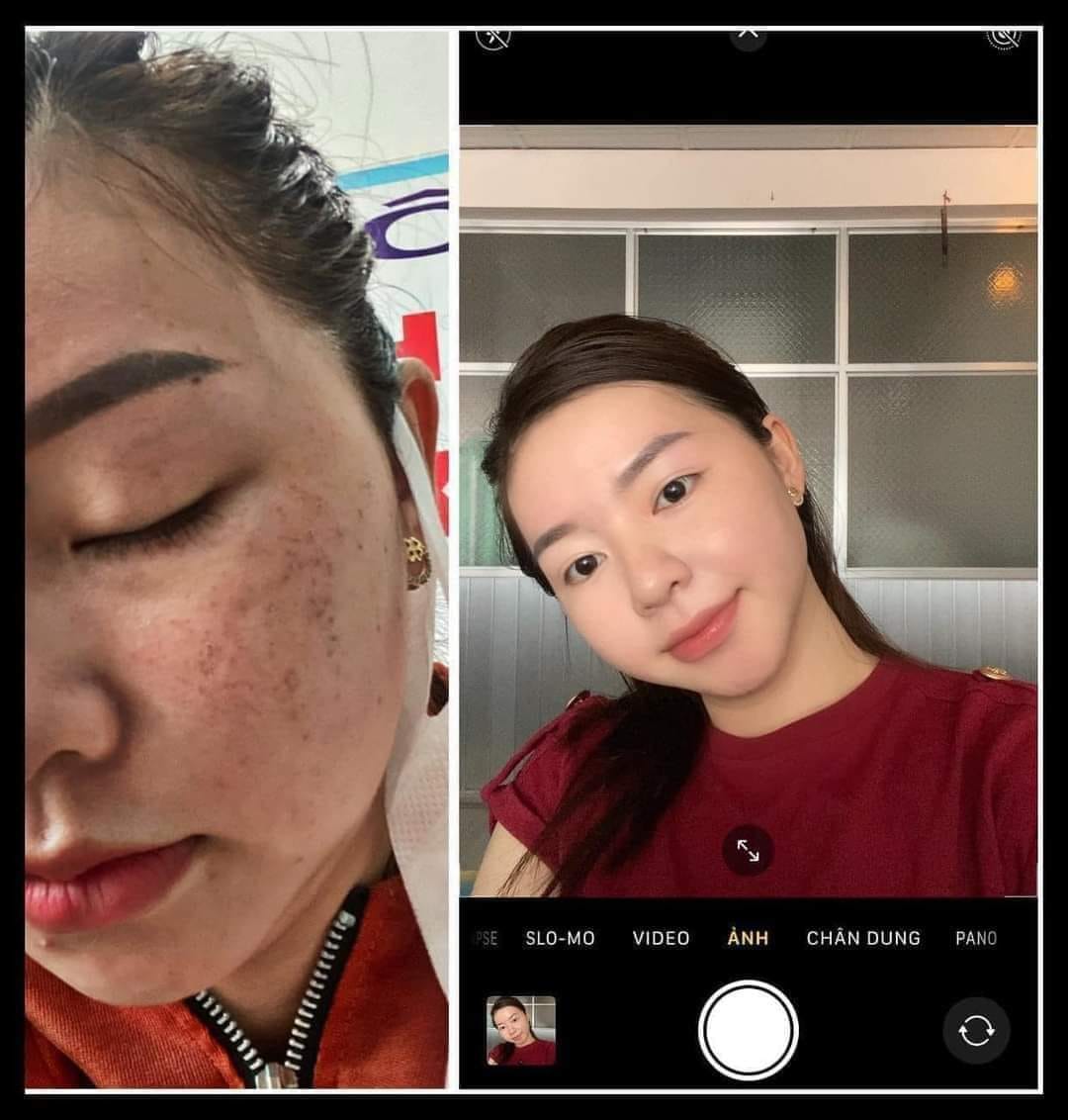 Review kem Demejine Hàn Quốc từ khách hàng