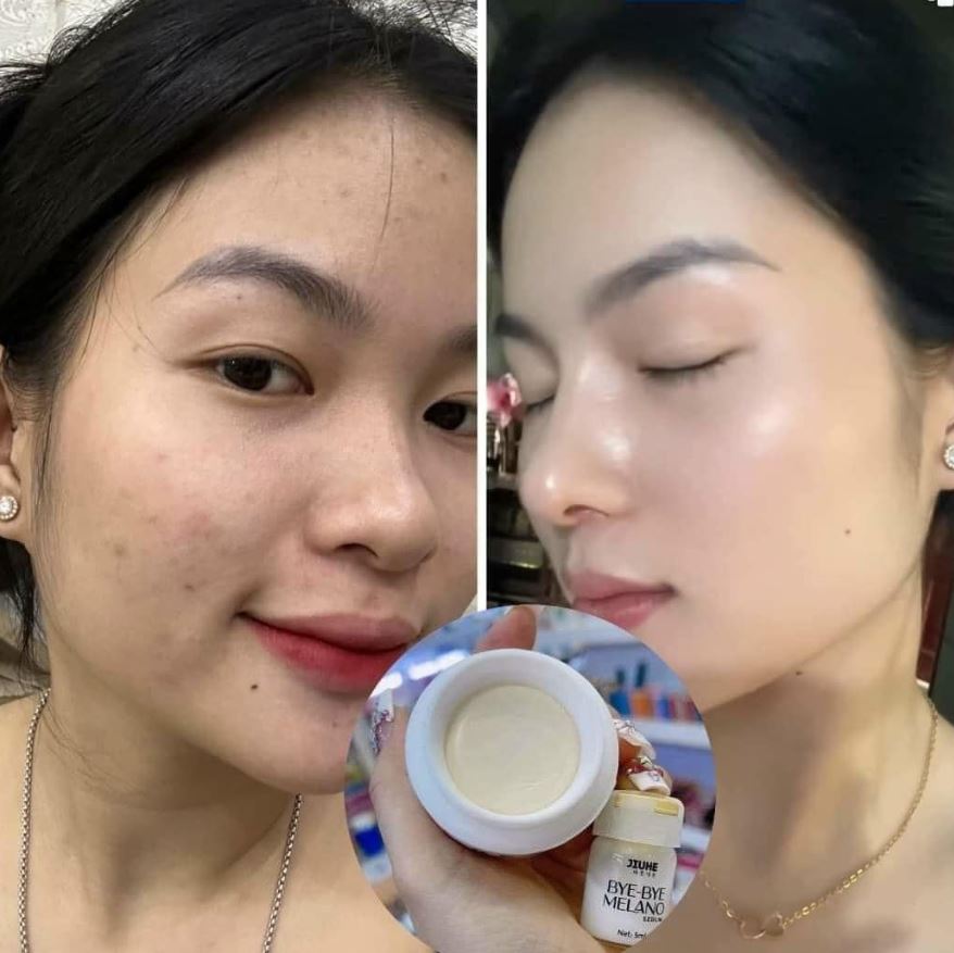 Làn da cải thiện rõ rệt trên da sau khoảng 2-4 tuần sử dụng đều đặn
