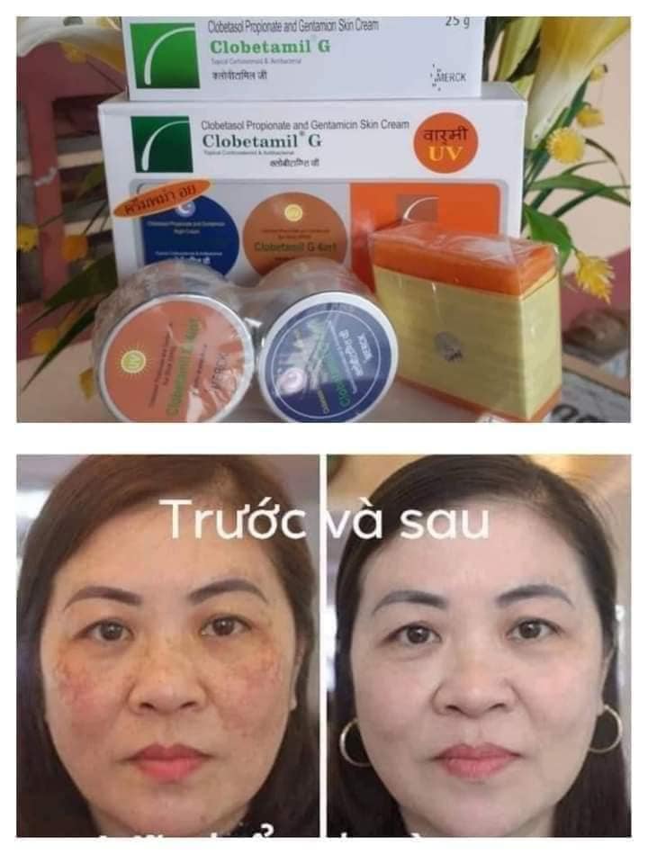 Ức chế quá trình sản sinh melanin, ngăn ngừa nám tái phát