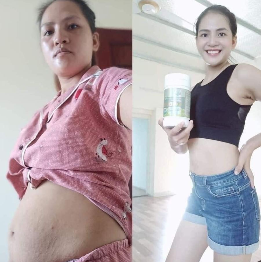 Khách hàng giảm cân thành công sau 2 liệu trình Powerlife