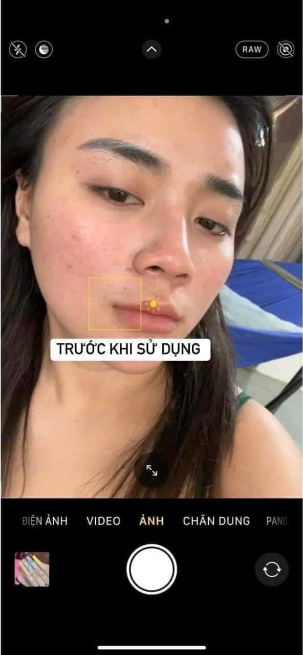 Kem Demejine Plus thích hợp cho mọi đối tượng sử dụng