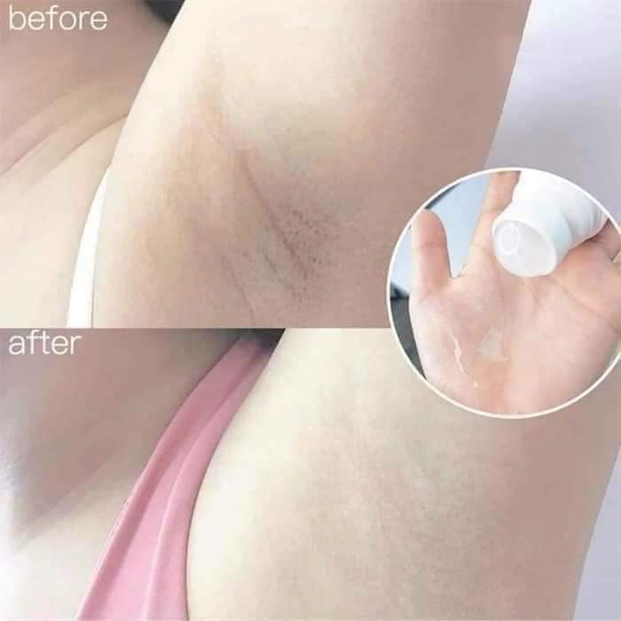 Sản phẩm giúp khử mùi và ngăn chặn tiết mồ hôi