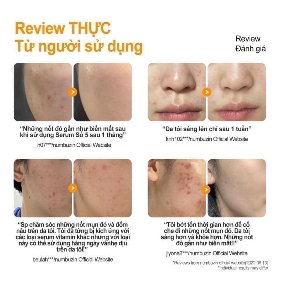 một số review đánh giá từ khách hàng về Tinh chất Numbuzin No.5