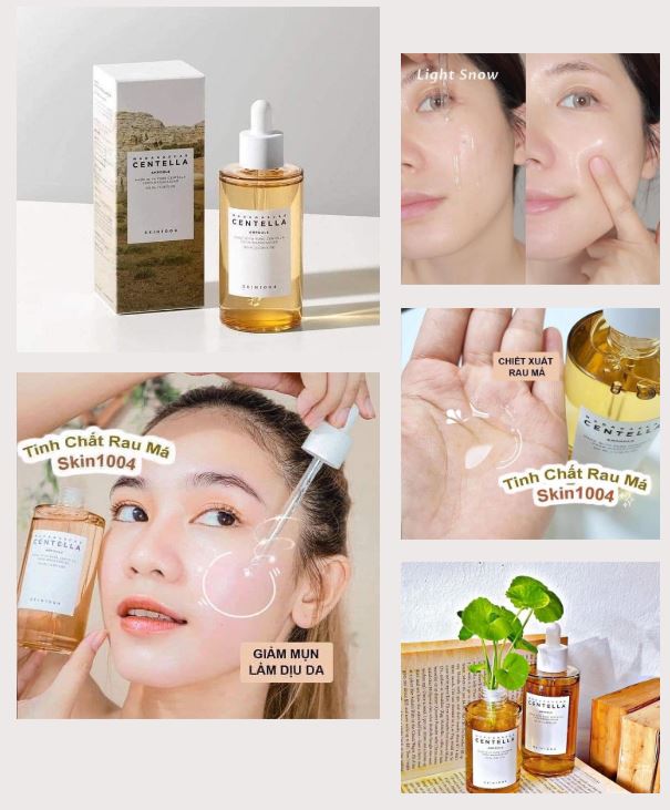 Làm dịu ngay các vết mẩn đỏ, kháng viêm và giảm sưng mụn hiệu quả