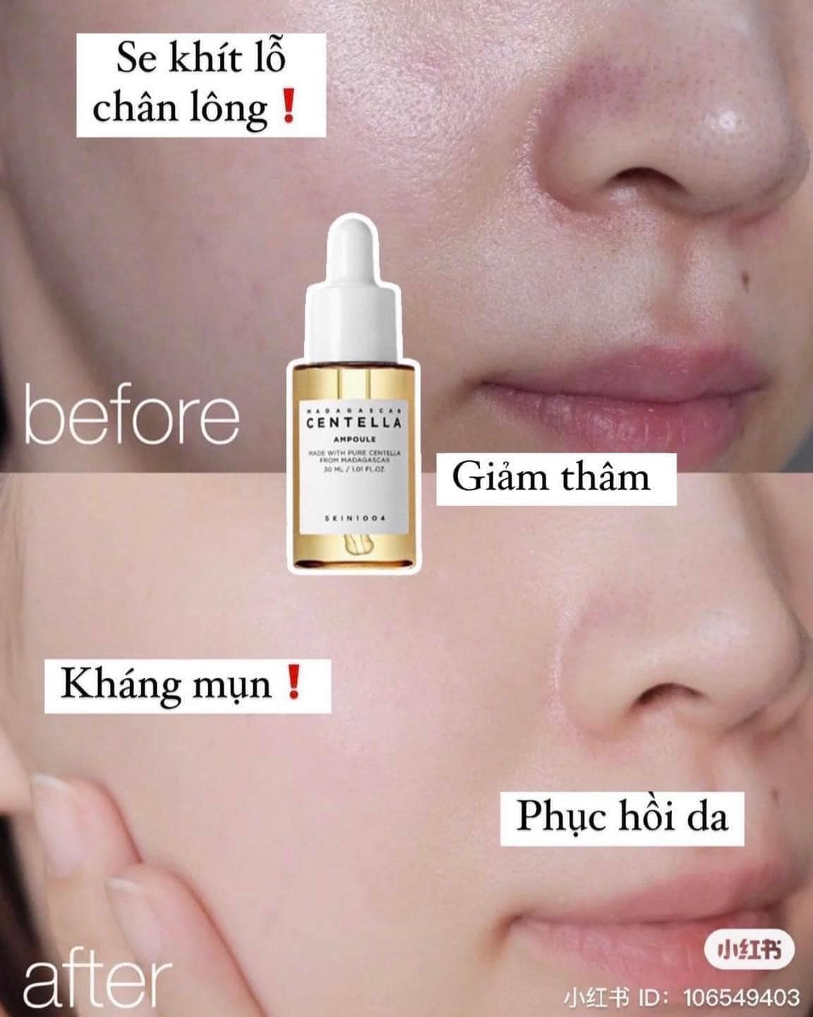 Tinh Chất Rau Má Skin1004 hiệu quả được nhiều khách hàng tin dùng