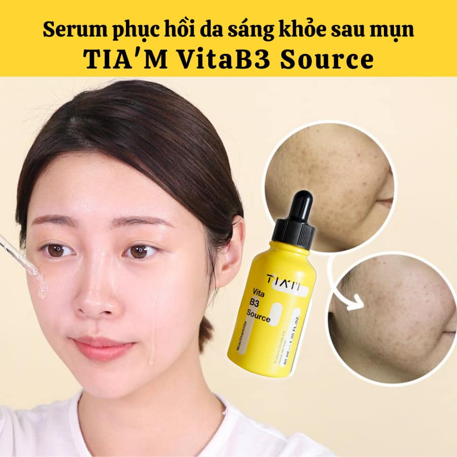 Đối tượng khuyên dùng
