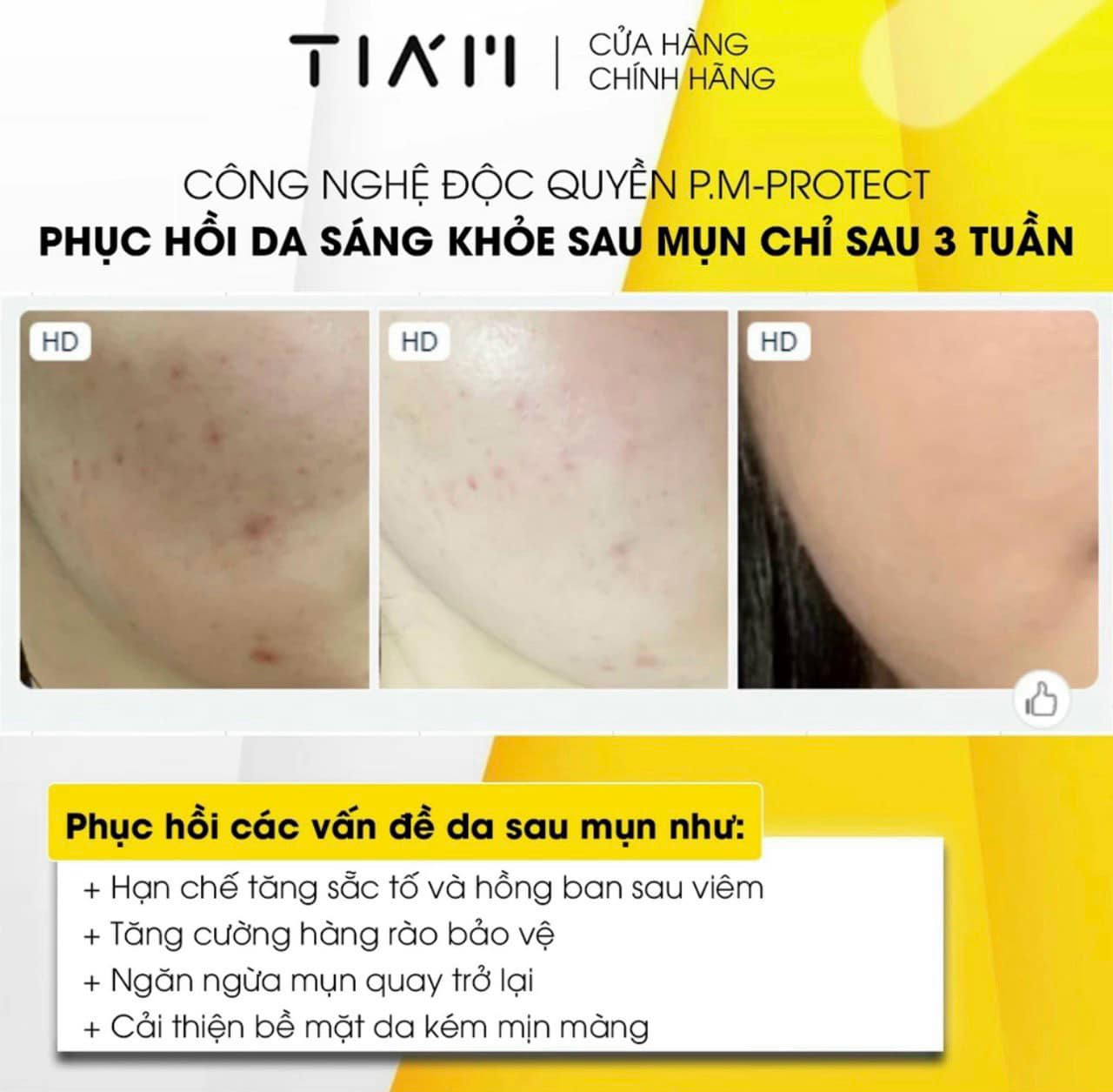 Serum Dưỡng Trắng Phục Hồi Da Mụn Tiam Vita B3 Source