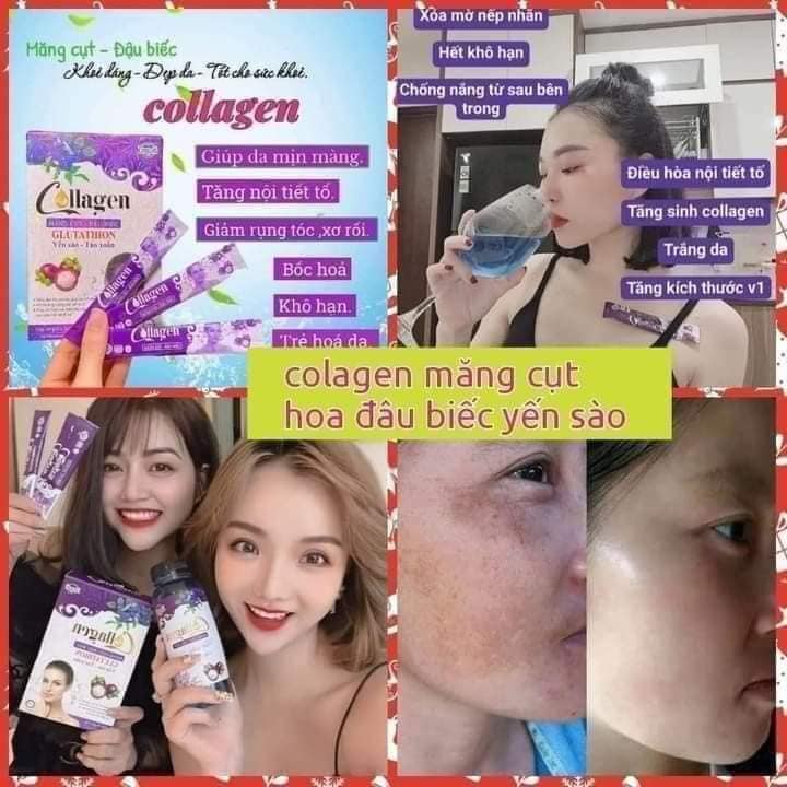 Phụ nữ trên 30 tuổi đang có dấu hiệu của quá trình lão hóa