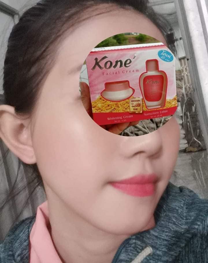 Một số review đánh giá từ khách hàng về kem trị nám Kone