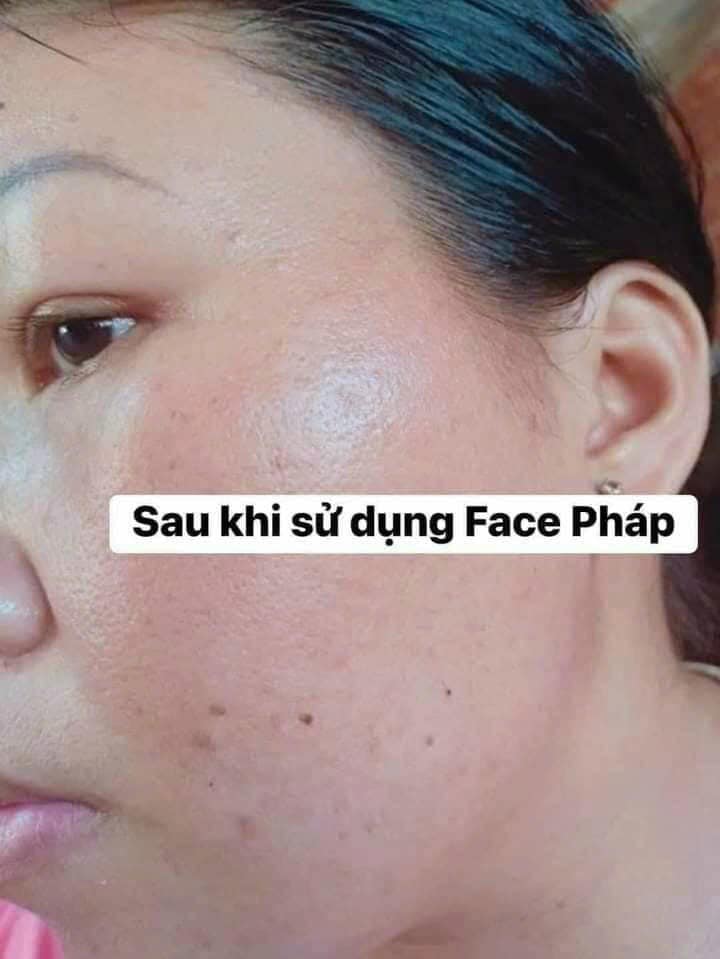 Hiệu quả sau khi sử dụng kem face pháp chính hãng sau 2 tuần