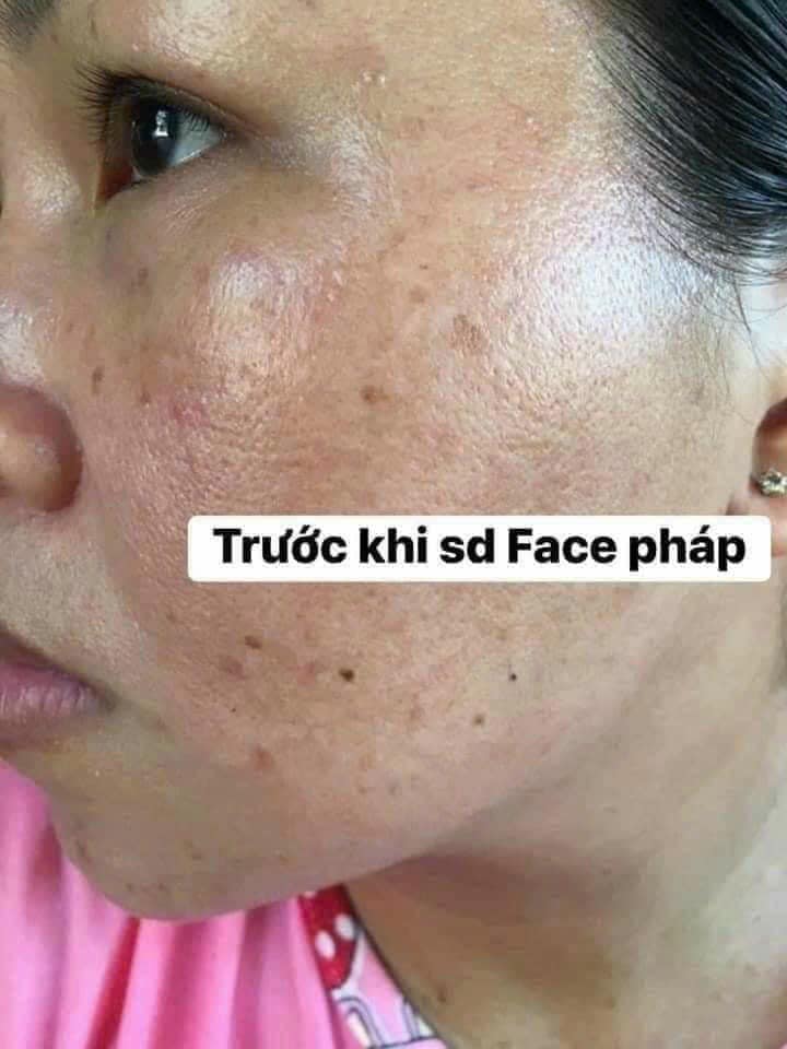 Khách hàng trước khi sử dụng kem face pháp 