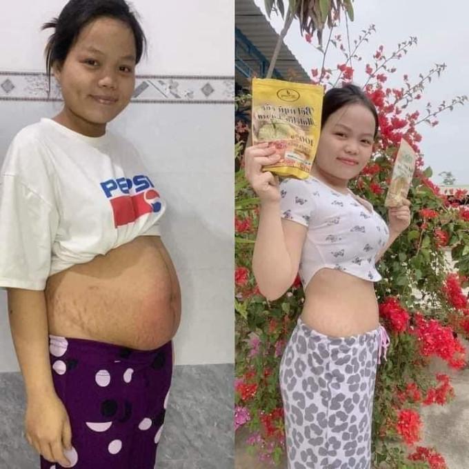 Hỗ trợ đốt cháy mỡ béo trong cơ thể, giúp tiêu hao mô mỡ.