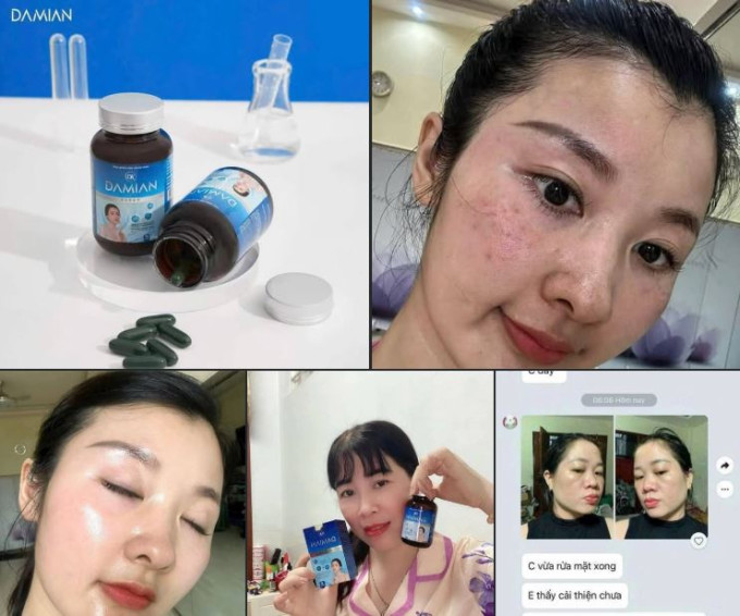 Nhiều khách hàng đã tin dùng Damin và hiệu quả