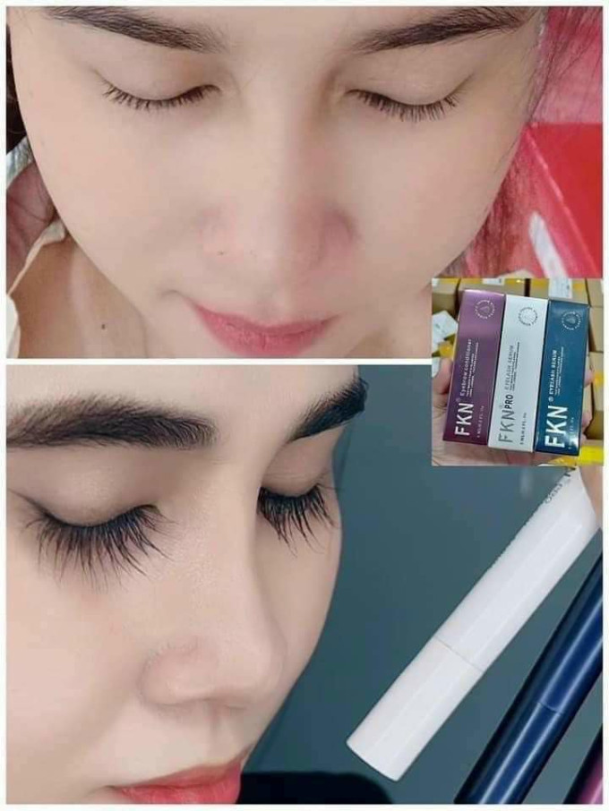 Kích thích mọc mi dài, dày và cong tự nhiên.