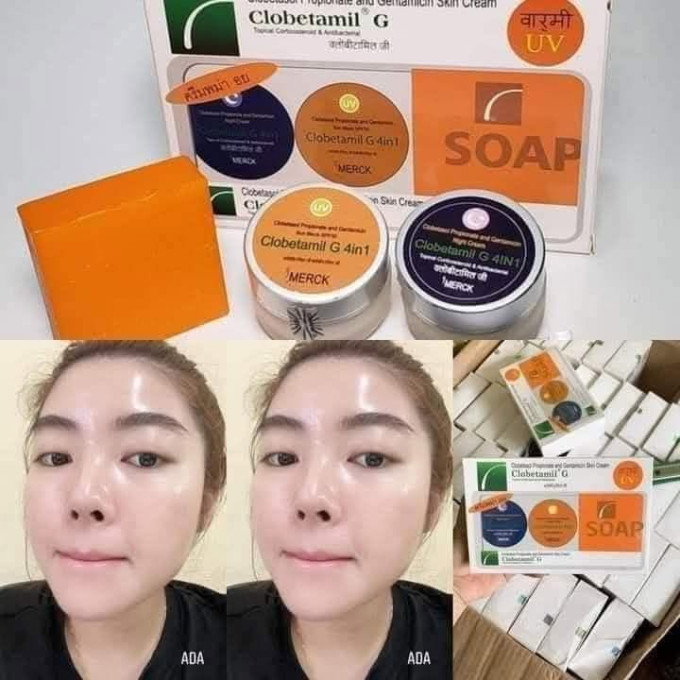 Bộ Nám Clobetamil G có tốt không