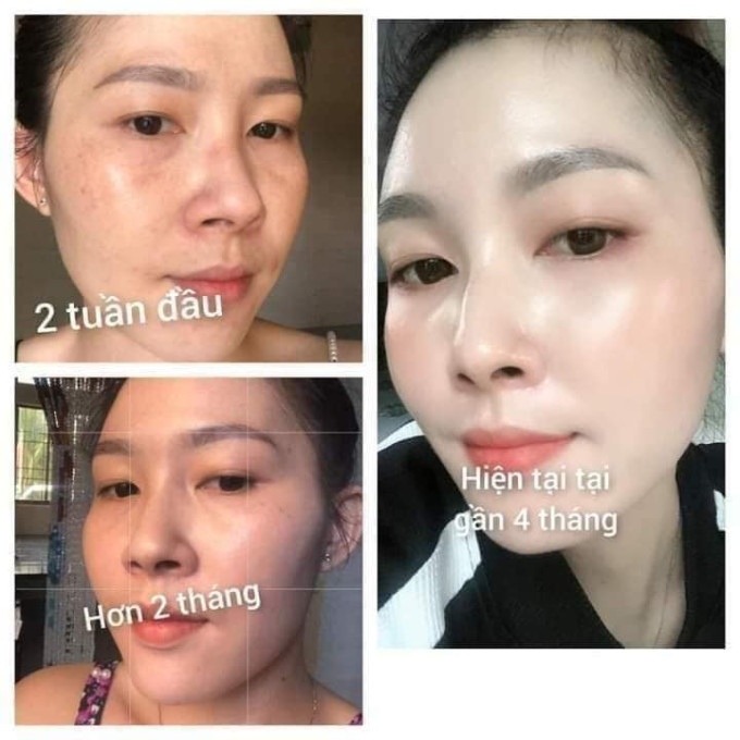 Công dụng Kem Silex Cao Cấp Nhật Bản